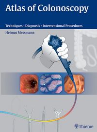 Produktbild: Atlas of Colonoscopy
