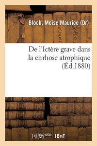 Produktbild: De l'Ict&egrave;re grave dans la cirrhose atrophique