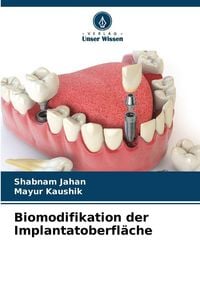 Produktbild: Biomodifikation der Implantatoberfl&auml;che
