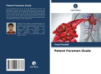 Produktbild: Patent Foramen Ovale