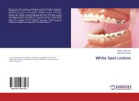 Produktbild: White Spot Lesions
