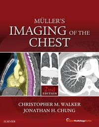 Produktbild: Muller's Imaging of the Chest E-Book