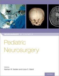 Produktbild: Pediatric Neurosurgery