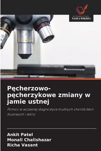 Produktbild: P&iquest;cherzowo-p&iquest;cherzykowe zmiany w jamie ustnej