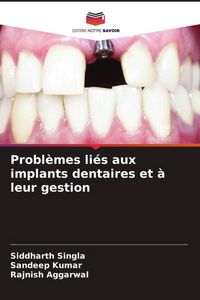 Produktbild: Probl&egrave;mes li&eacute;s aux implants dentaires et &agrave; leur gestion