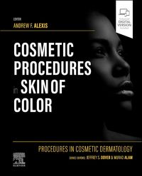 Produktbild: Procedures in Cosmetic Dermatology: Cosmetic Procedures in Skin of Color