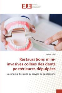 Produktbild: Restaurations mini-invasives coll&eacute;es des dents post&eacute;rieures d&eacute;pulp&eacute;es