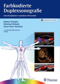 Produktbild: Farbkodierte Duplexsonografie