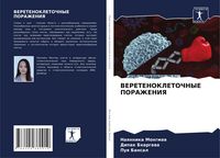 Produktbild: Veretenokletochnye Porazheniya