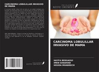 Produktbild: Carcinoma Lobulillar Invasivo De Mama