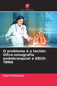 Produktbild: O problema &eacute; o tecido: Ultra-sonografia endobronquial e EBUS-TBNA