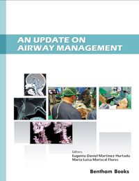 Produktbild: An Update on Airway Management