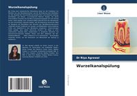 Produktbild: Wurzelkanalsp&uuml;lung