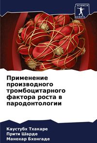 Produktbild: Primenenie proizwodnogo trombocitarnogo faktora rosta w parodontologii
