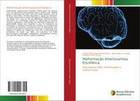 Produktbild: Malforma&ccedil;&atilde;o Arteriovenosa Encef&aacute;lica