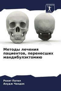 Produktbild: Metody lecheniq pacientow, perenesshih mandibul&auml;ktomi&uuml;