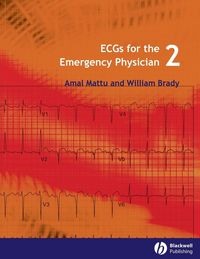 Produktbild: Ecgs for the Emergency Physician 2