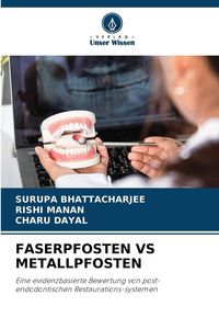 Produktbild: Faserpfosten Vs Metallpfosten