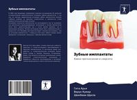 Produktbild: Zubnye implantaty