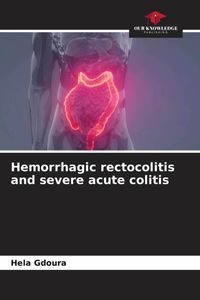 Produktbild: Hemorrhagic rectocolitis and severe acute colitis