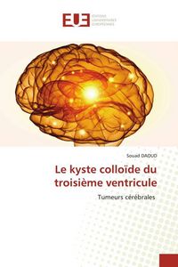 Produktbild: Le kyste collo&iuml;de du troisi&egrave;me ventricule