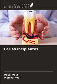 Produktbild: Caries incipientes