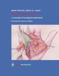 Produktbild: Dupuytren's Disease
