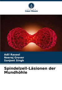 Produktbild: Spindelzell-L&auml;sionen der Mundh&ouml;hle