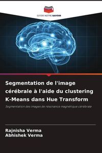Produktbild: Segmentation de l'image c&eacute;r&eacute;brale &agrave; l'aide du clustering K-Means dans Hue Transform
