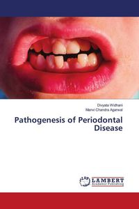 Produktbild: Pathogenesis of Periodontal Disease