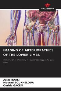 Produktbild: Imaging Of Arteriopathies Of The Lower Limbs