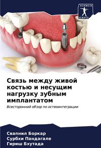 Produktbild: Swqz' mezhdu zhiwoj kost'&uuml; i nesuschim nagruzku zubnym implantatom