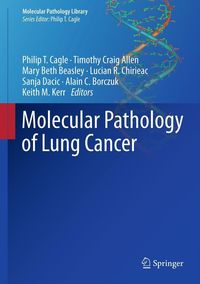 Produktbild: Molecular Pathology of Lung Cancer