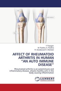 Produktbild: Affect Of Rheumatoid Arthritis in Human "an Auto Immune Disease"