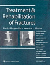Produktbild: Treatment and Rehabilitation of Fractures