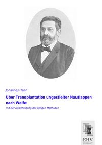 Produktbild: &Uuml;ber Transplantation ungestielter Hautlappen nach Wolfe