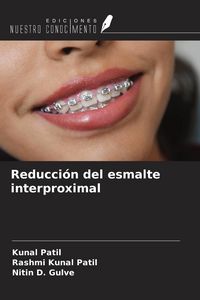 Produktbild: Reducci&oacute;n del esmalte interproximal