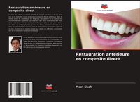 Produktbild: Restauration ant&eacute;rieure en composite direct