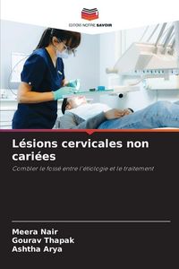 Produktbild: L&eacute;sions cervicales non cari&eacute;es