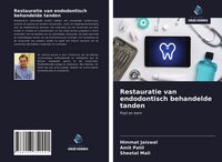 Produktbild: Restauratie van endodontisch behandelde tanden