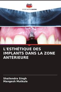 Produktbild: L'esth&eacute;tique des Implants Dans La Zone Ant&eacute;rieure
