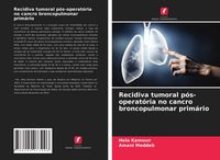 Produktbild: Recidiva tumoral p&oacute;s-operat&oacute;ria no cancro broncopulmonar prim&aacute;rio