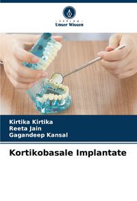 Produktbild: Kortikobasale Implantate