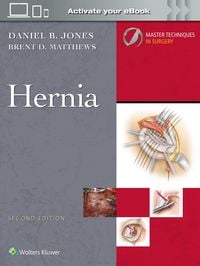 Produktbild: Master Techniques in Surgery: Hernia: Print + eBook with Multimedia