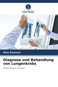 Produktbild: Diagnose und Behandlung von Lungenkrebs
