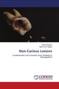 Produktbild: Non-Carious Lesions