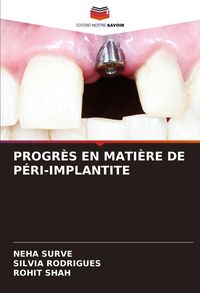 Produktbild: Progr&egrave;s En Mati&egrave;re De P&eacute;ri-Implantite