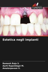 Produktbild: Estetica negli impianti