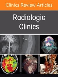 Produktbild: Musculoskeletal Interventional Radiology, an Issue of Radiologic Clinics of North America