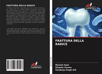 Produktbild: Frattura Della Radice